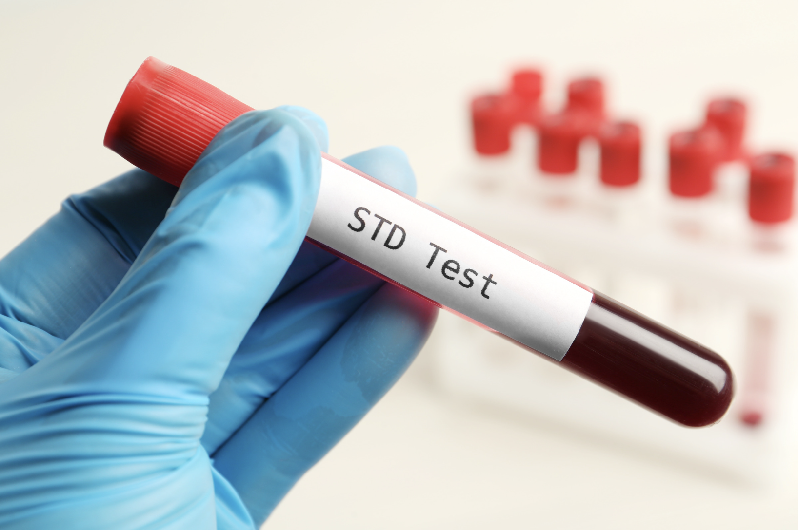 Comprehensive Guide to STD Testing in Bali: Where, Why, and How