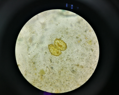 Top 5 Reasons Why Diagnosing Parasites of Bali Belly is Important