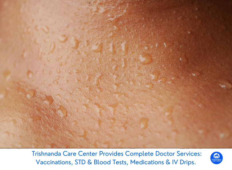 Bali Belly and Dehydration: Why Aussie travelers underestimate heat-loss